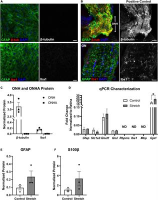 Stretch stress propels glutamine dependency and glycolysis in optic nerve head astrocytes